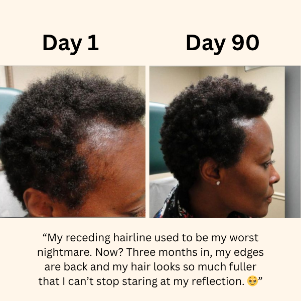 TheraCrown™ Root Revival Scalp Massager