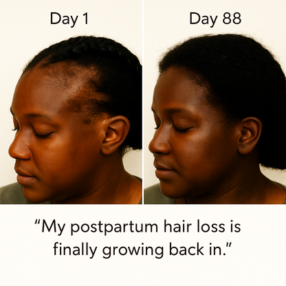 TheraCrown™ Root Revival Scalp Massager