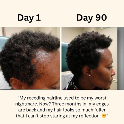 TheraCrown™ Root Revival Scalp Massager
